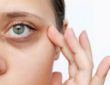 Tipps gegen Augenringe